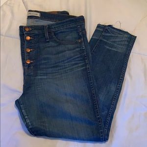 Madewell 10” High Riser Skinny Skinny Jeans